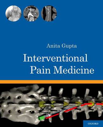 Cover image for Interventional Pain Medicine