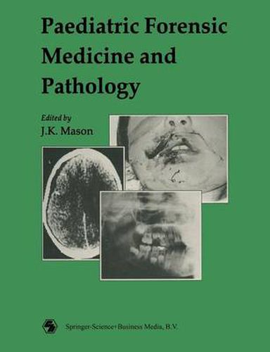 Cover image for Paediatric Forensic Medicine and Pathology