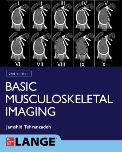 Cover image for Basic Musculoskeletal Imaging, Second Edition