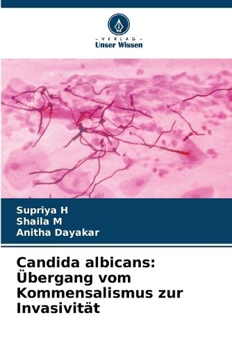 Cover image for Candida albicans