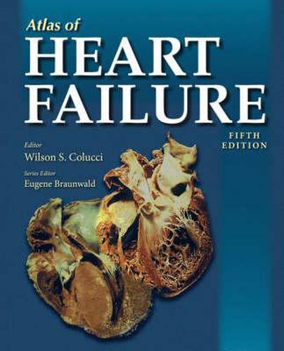 Cover image for Atlas of Heart Failure
