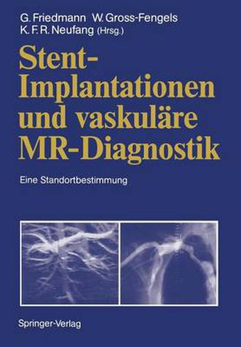 Cover image for Stent-Implantationen und Vaskulare MR-Diagnostik