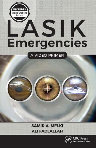 Cover image for LASIK Emergencies: A Video Primer
