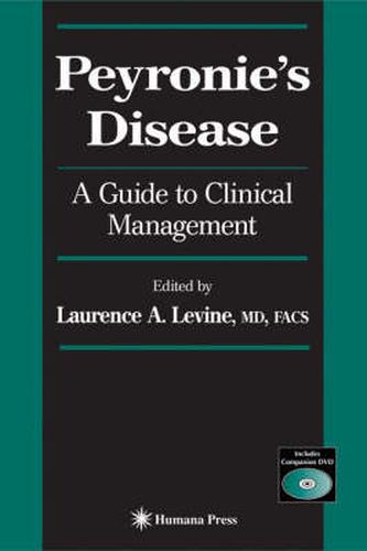 Cover image for Peyronie's Disease: A Guide to Clinical Management