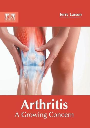 Cover image for Arthritis: A Growing Concern