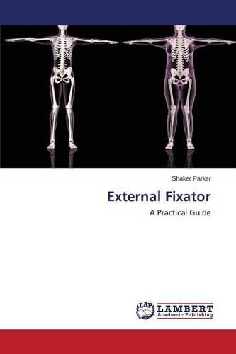 Cover image for External Fixator