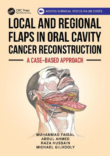 Cover image for Local and Regional Flaps in Oral Cavity Cancer Reconstruction