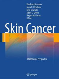 Cover image for Skin Cancer - A World-Wide Perspective
