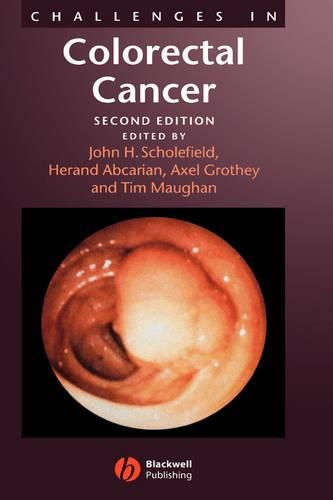 Cover image for Challenges in Colorectal Cancer