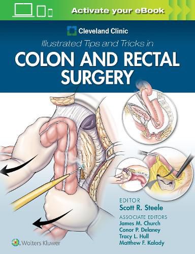 Cover image for Cleveland Clinic Illustrated Tips and Tricks in Colon and Rectal Surgery