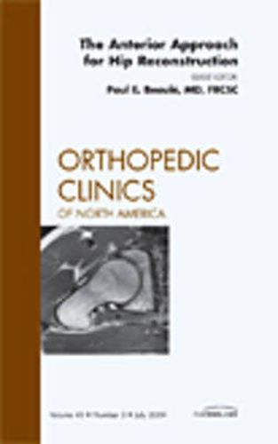 Cover image for The Anterior Approach for Hip Reconstruction, An Issue of Orthopedic Clinics