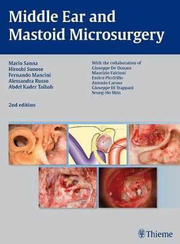 Middle Ear and Mastoid Microsurgery