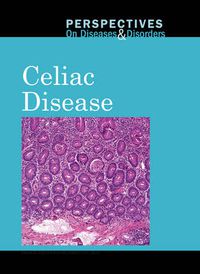 Cover image for Celiac Disease