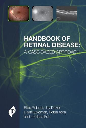 Cover image for Handbook of Retinal Disease: a Case-based Approach