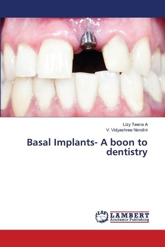 Cover image for Basal Implants- A boon to dentistry