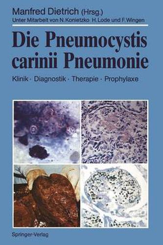 Cover image for Die Pneumocystis carinii Pneumonie: Klinik * Diagnostik * Therapie * Prophylaxe