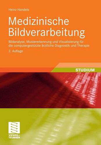 Cover image for Medizinische Bildverarbeitung: Bildanalyse, Mustererkennung Und Visualisierung Fur Die Computergestutzte AErztliche Diagnostik Und Therapie