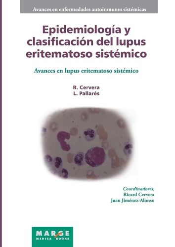 Cover image for Epidemiologia y clasificacion del lupus eritematoso sistemico