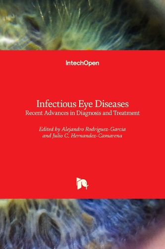 Cover image for Infectious Eye Diseases: Recent Advances in Diagnosis and Treatment