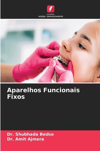 Cover image for Aparelhos Funcionais Fixos