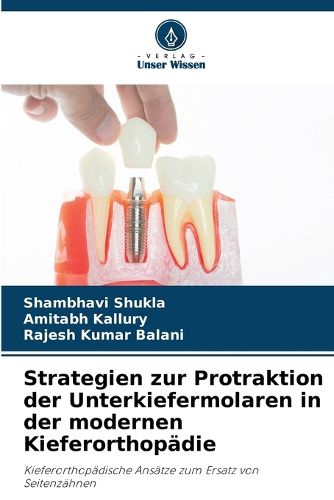 Cover image for Strategien zur Protraktion der Unterkiefermolaren in der modernen Kieferorthopaedie