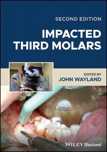 Cover image for Impacted Third Molars