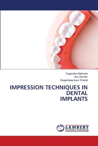 Cover image for Impression Techniques in Dental Implants