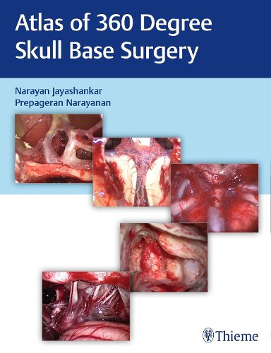 Cover image for Atlas of 360 Degree Skull Base Surgery
