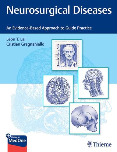 Cover image for Neurosurgical Diseases: An Evidence-Based Approach to Guide Practice