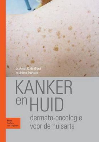 Cover image for Kanker En Huid: Dermato-Oncologie Voor de Huisarts