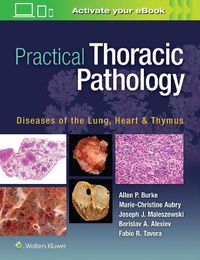 Cover image for Practical Thoracic Pathology: Diseases of the Lung, Heart, and Thymus