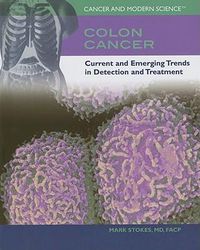 Cover image for Colon Cancer