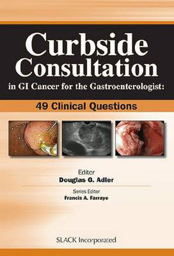 Cover image for Curbside Consultation in GI Cancer for the Gastroenterologist: 49 Clinical Questions