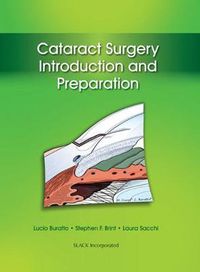 Cover image for Cataract Surgery: Introduction and Preparation