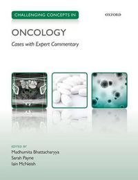 Cover image for Challenging Concepts in Oncology
