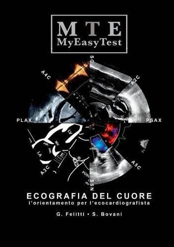 Cover image for Ecografia Del Cuore - Myeasytest