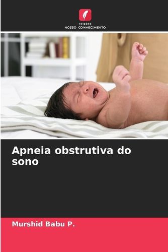 Cover image for Apneia obstrutiva do sono
