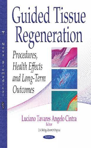 Cover image for Guided Tissue Regeneration: Procedures, Health Effects & Long-Term Outcomes