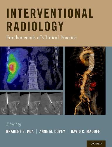 Cover image for Interventional Radiology: Fundamentals of Clinical Practice