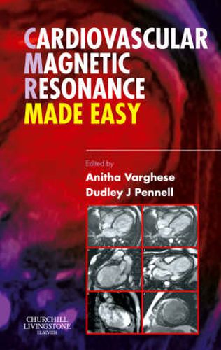 Cover image for Cardiovascular Magnetic Resonance Made Easy