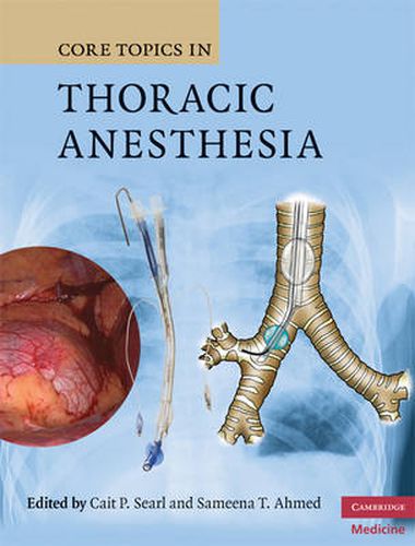 Cover image for Core Topics in Thoracic Anesthesia