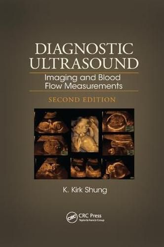 Cover image for Diagnostic Ultrasound: Imaging and Blood Flow Measurements, Second Edition