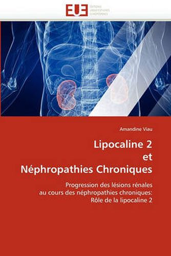 Cover image for Lipocaline 2 Et Nephropathies Chroniques