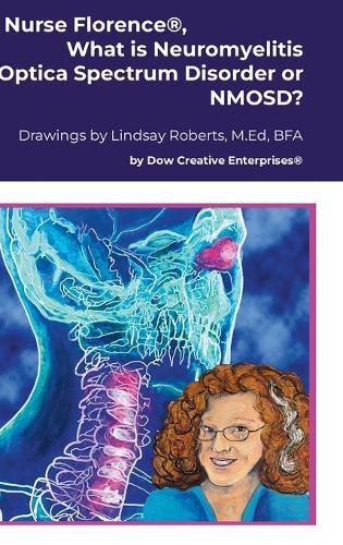 Cover image for Nurse Florence(R), What is Neuromyelitis Optica Spectrum Disorder or NMOSD?
