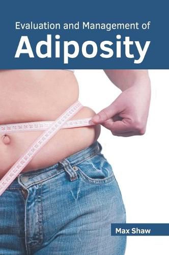 Cover image for Evaluation and Management of Adiposity