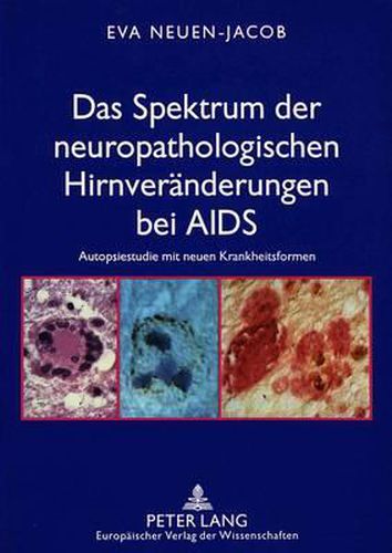 Cover image for Das Spektrum Der Neuropathologischen Hirnveraenderungen Bei AIDS: Autopsiestudie Mit Neuen Krankheitsformen