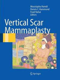 Cover image for Vertical Scar Mammaplasty