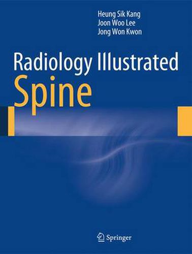 Cover image for Radiology Illustrated: Spine