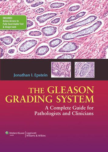 Cover image for The Gleason Grading System: A Complete Guide for Pathologist and Clinicians