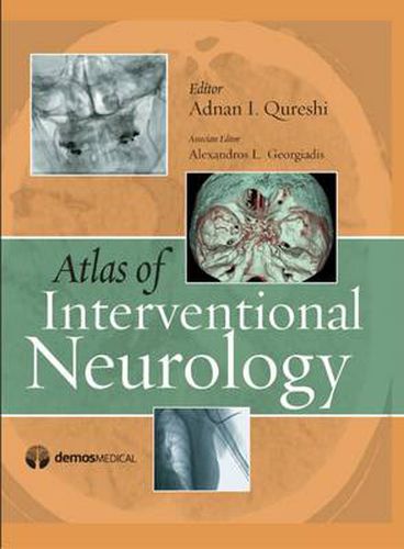 Cover image for Atlas of Interventional Neurology